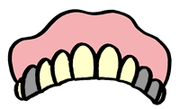 歯の黄ばみ・ヤニ